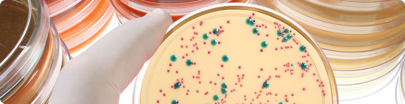 Бактериологическое исследование отделяемого половых органов