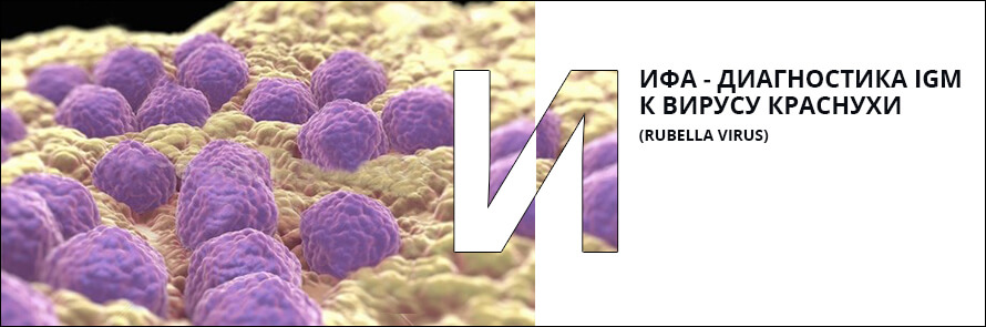 ИФА - диагностика IgМ к вирусу краснухи (Rubella virus)