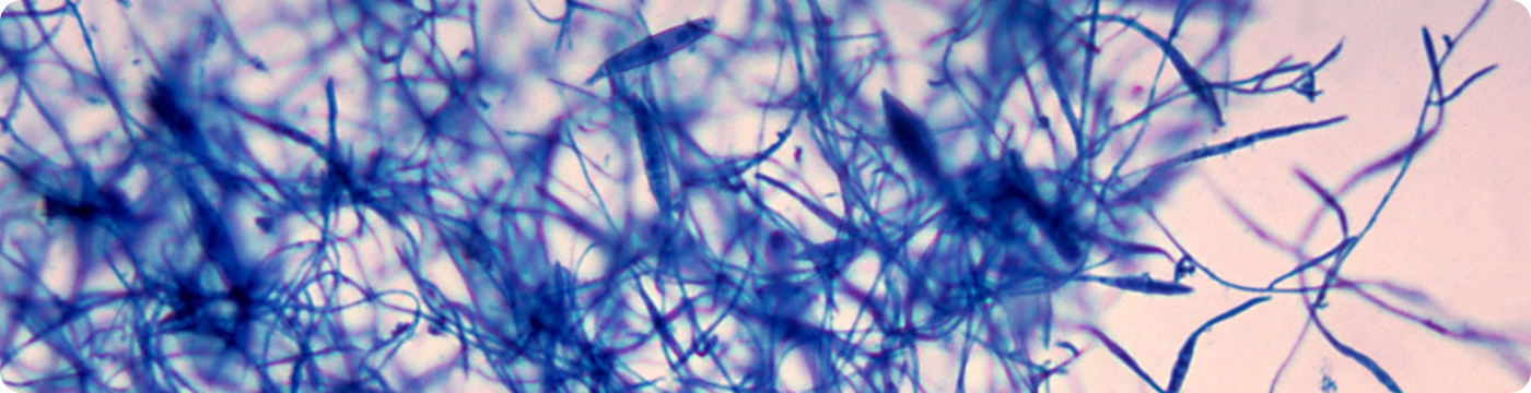Микроскопическое исследование на грибковые заболевания (кожа, ногти, волосы)