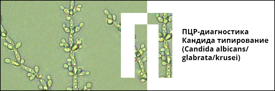 Как определить кандиду. ПЦР кандида альбиканс. ПЦР на кандиду. Кандидоз ПЦР.