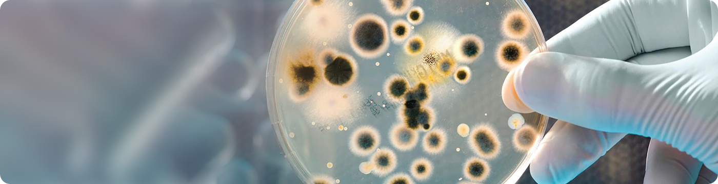 Исследование на уреаплазму (Ureaplasma urealyticum) с определением чувствительности к антибиотикам