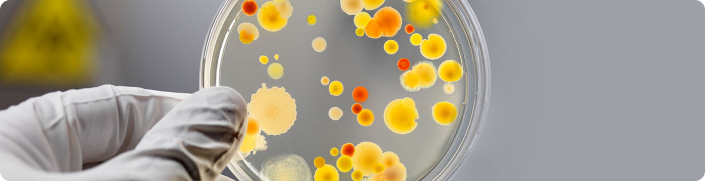 Бактериологическое исследование секрета простаты (эякулята) с определением чувствительности к антимикробным препаратам