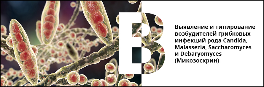 Saccharomyces cerevisiae что это в гинекологии. ea33b6c77331bb7d69a13c636a69d207. Saccharomyces cerevisiae что это в гинекологии фото. Saccharomyces cerevisiae что это в гинекологии-ea33b6c77331bb7d69a13c636a69d207. картинка Saccharomyces cerevisiae что это в гинекологии. картинка ea33b6c77331bb7d69a13c636a69d207